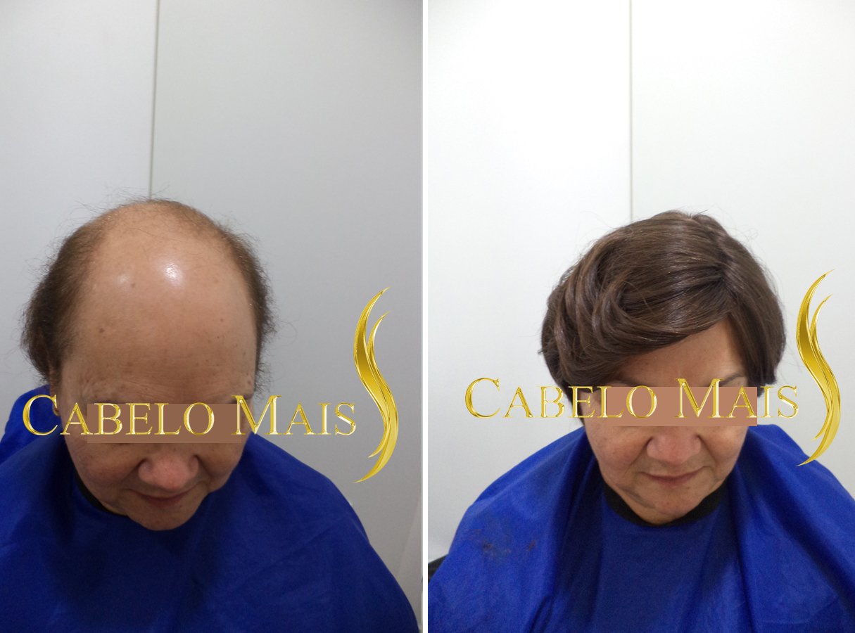 mega-hair-porto-alegre-antes-depois-3